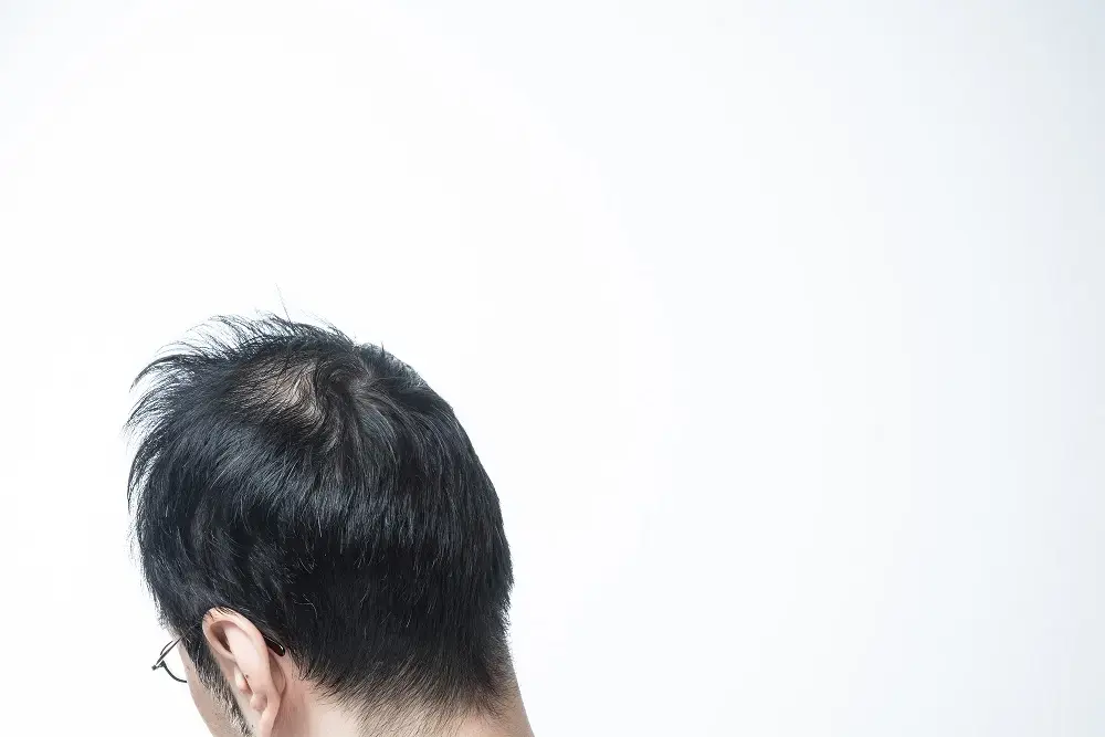 寝癖が原因で薄毛(ハゲ)になる? 寝癖の原因と直し方を知ろう!