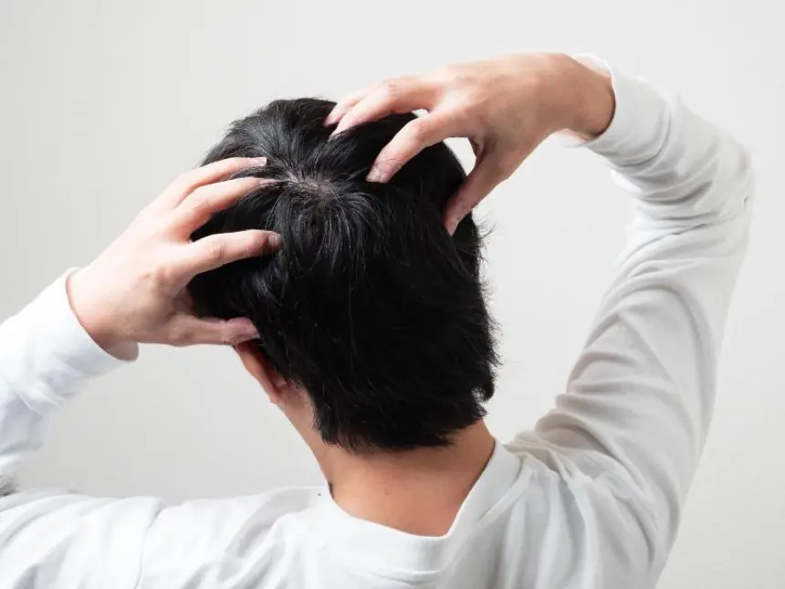 フケの原因は病気?考えられる原因からフケの効果的な対策・予防法まで解説