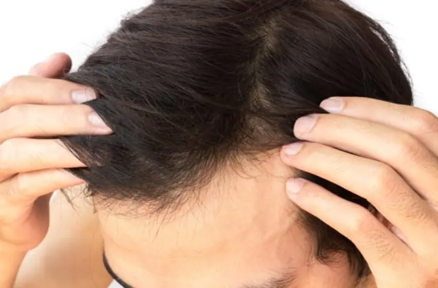 頭皮の皮脂の原因は?起こり得るトラブルや皮脂を抑える方法を紹介