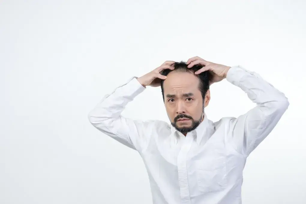 毛根が死滅したらアウト?髪の毛を復活させるために知るべきこと