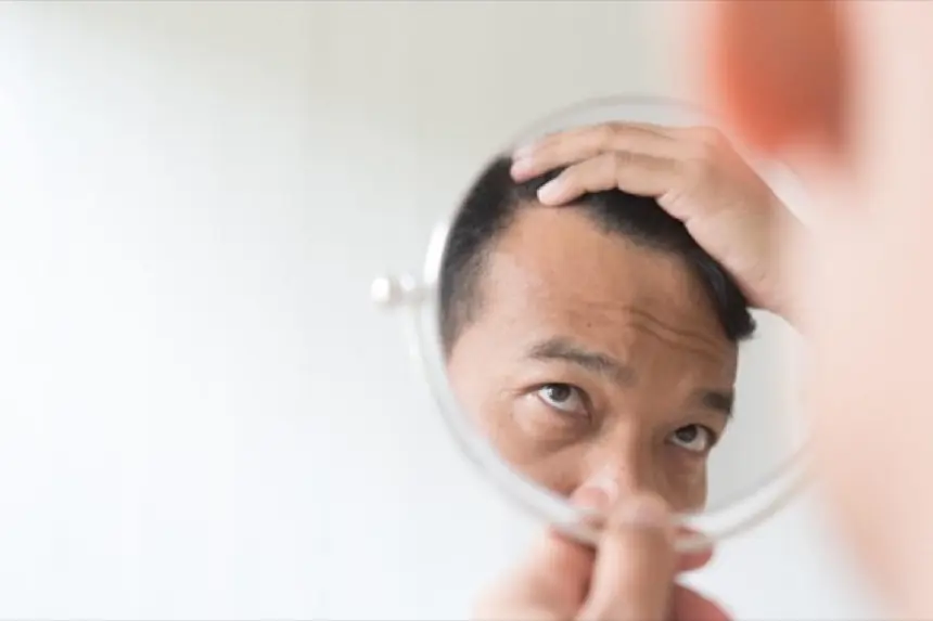 頭皮のむくみの原因は?セルフチェック方法や解消方法まで徹底解説